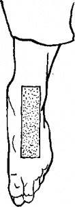 32