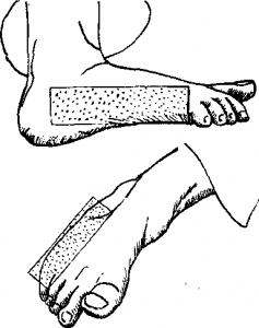 35