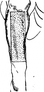 46